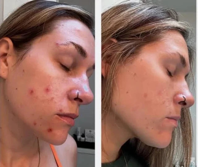 Beef Tallow Moisturizing Face Cream