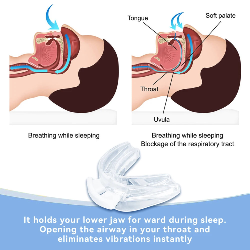 Stop Snoring & Bruxism Silicone Mouth Guard