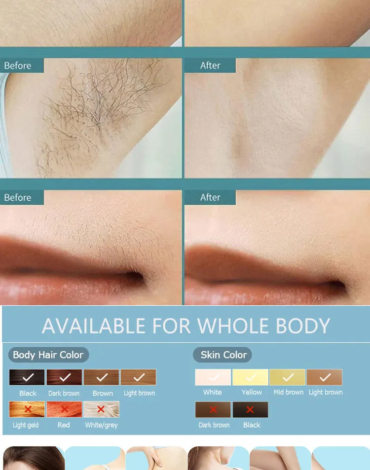 IPL Hair Removal Device 500,000 Flashes