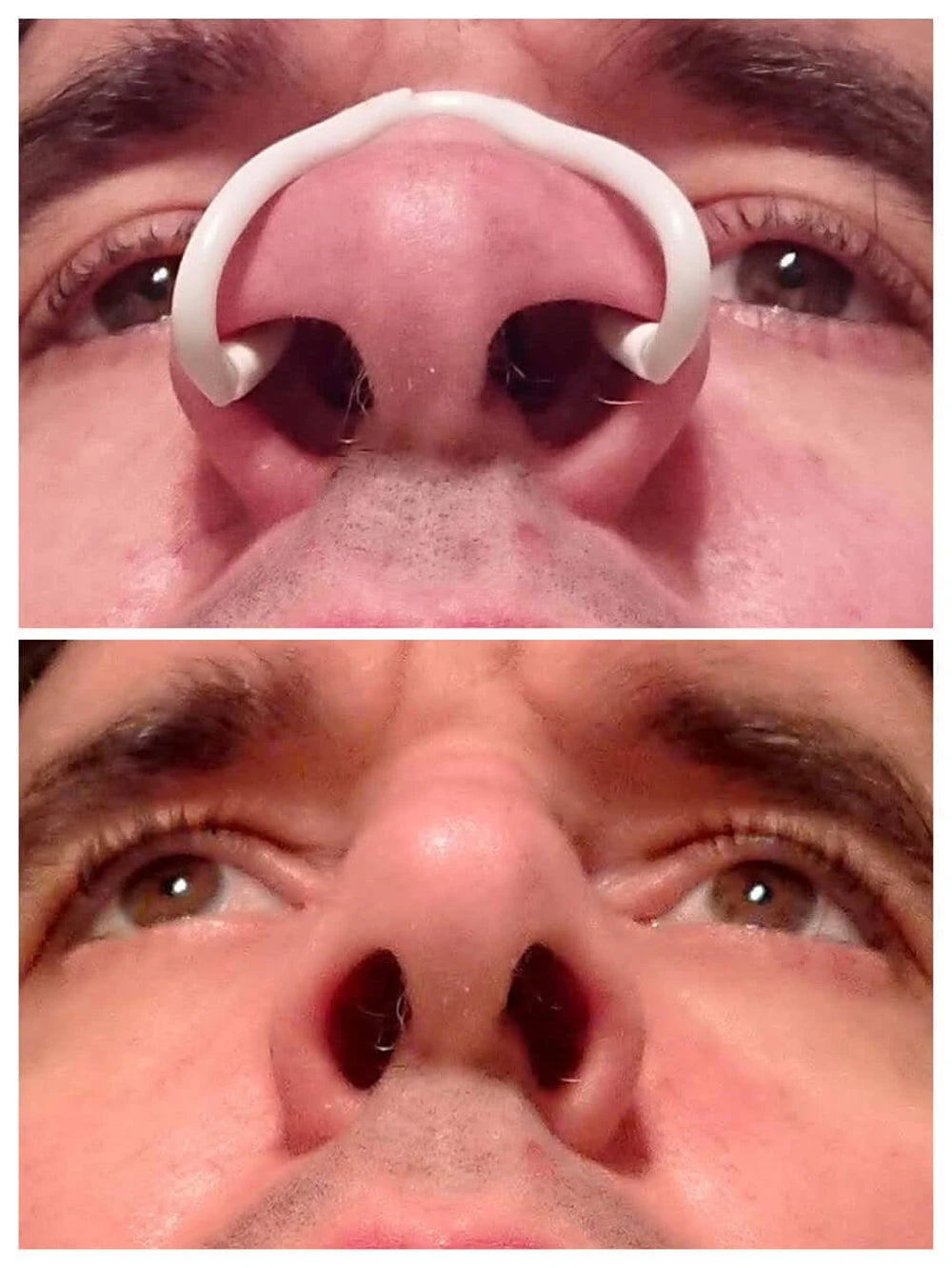 Silicone Nasal Dilator Anti-Snoring Clip